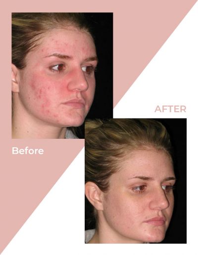 Jessie E Makeup & Beauty-Skin Treatments