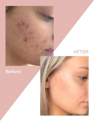 Jessie E Makeup & Beauty-Skin Treatments